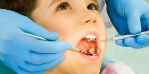 Top Questions About Early Orthodontic Evaluation
